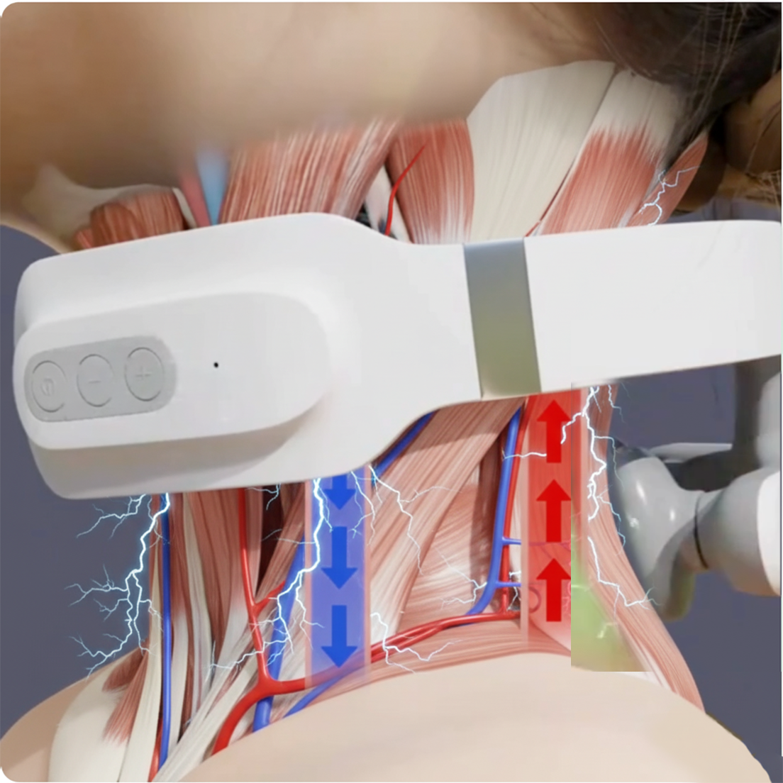 Power Neck Pro 2.0 – EMS und TENS Nackenmassage